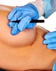 3749C8DF-D0C4-4450-939D-F86667F168D6