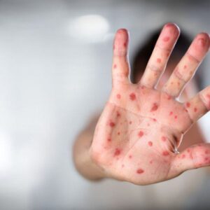 dbc25ec006076b11bb295987ebd0490b